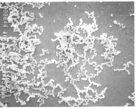 Quest-AquaVantage-hardness crystals post treatment-Aragonite.